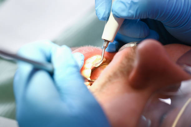 Best Pediatric Emergency Dentist in Morrison, IL