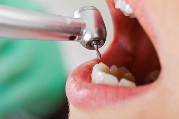 Best Weekend Emergency Dentist in Morrison, IL